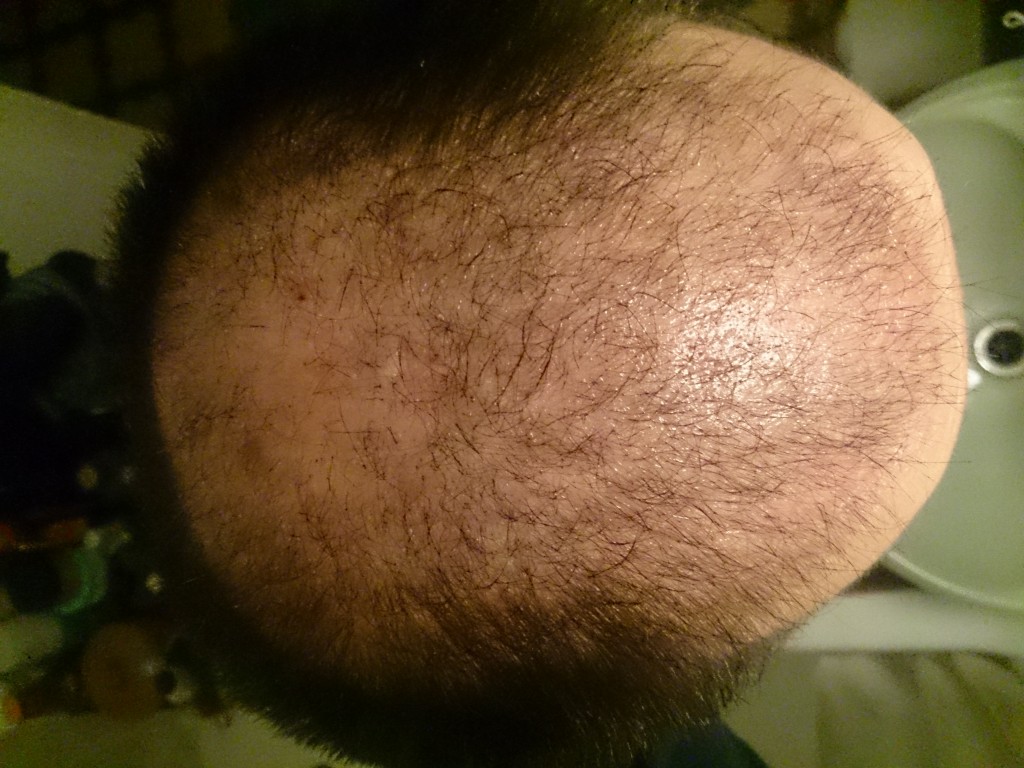 1 mes, 5 días, arriba, poca luz