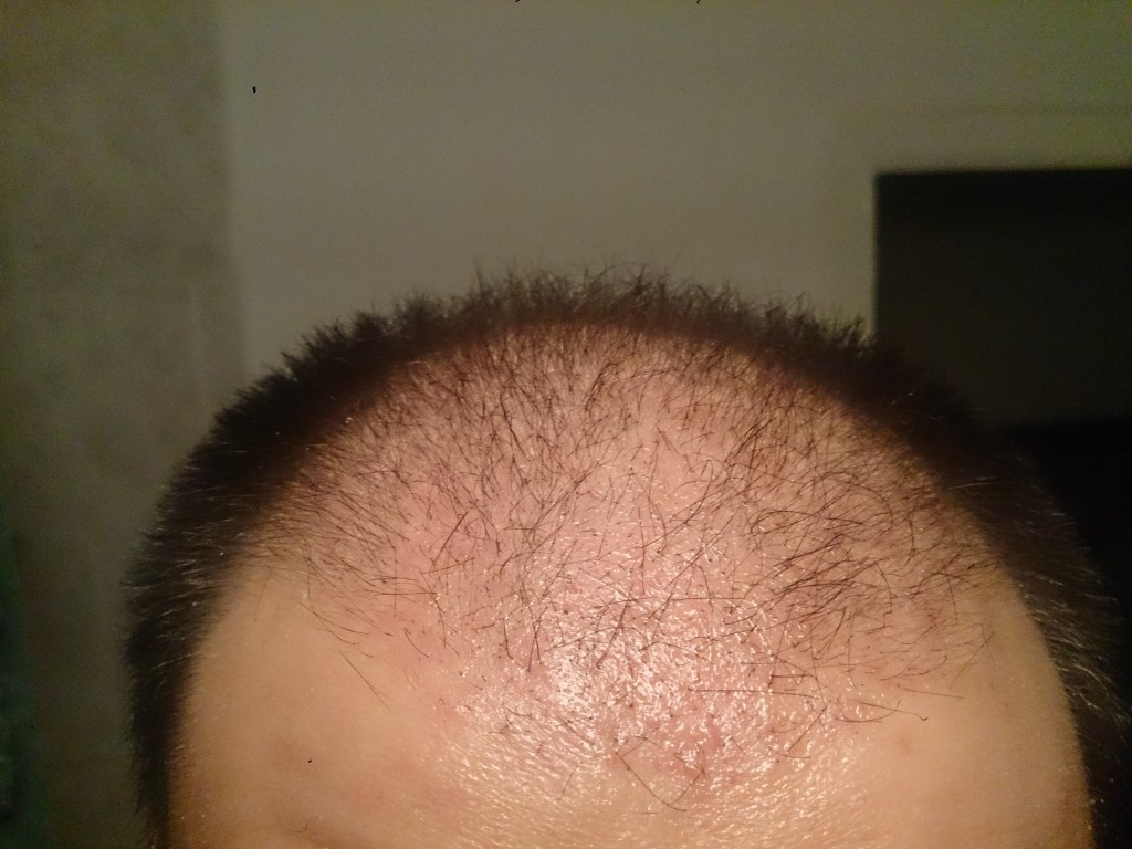 1 mes, 5 días, frente, cerca flash
