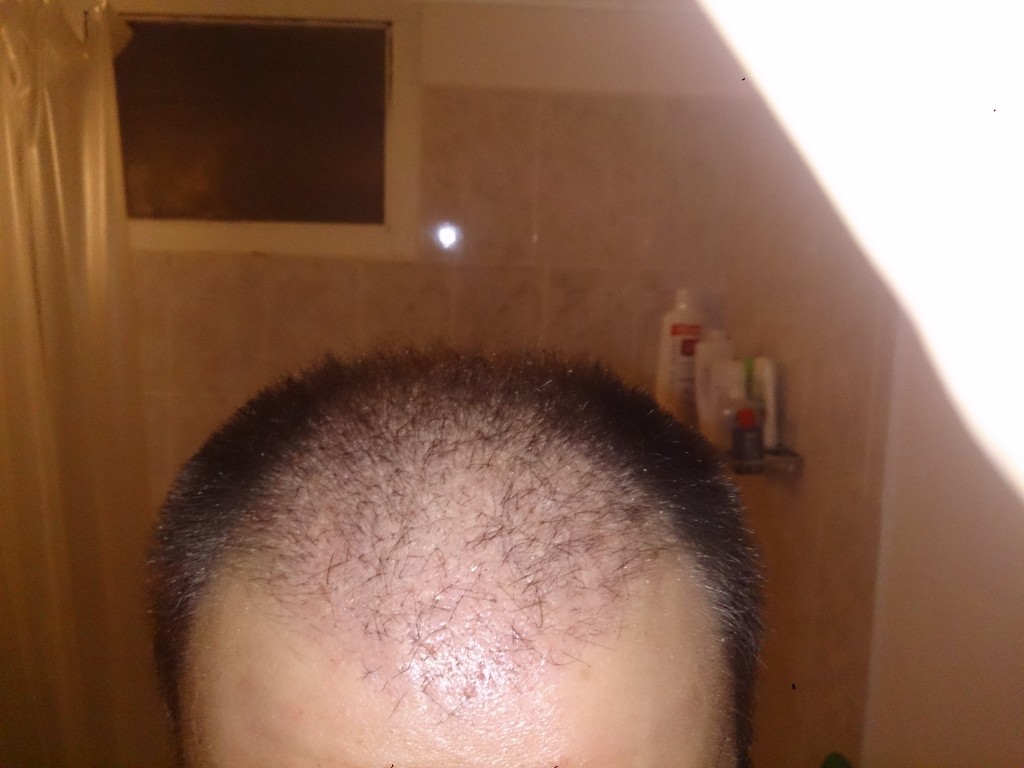 1 mes, 5 días, frente flash