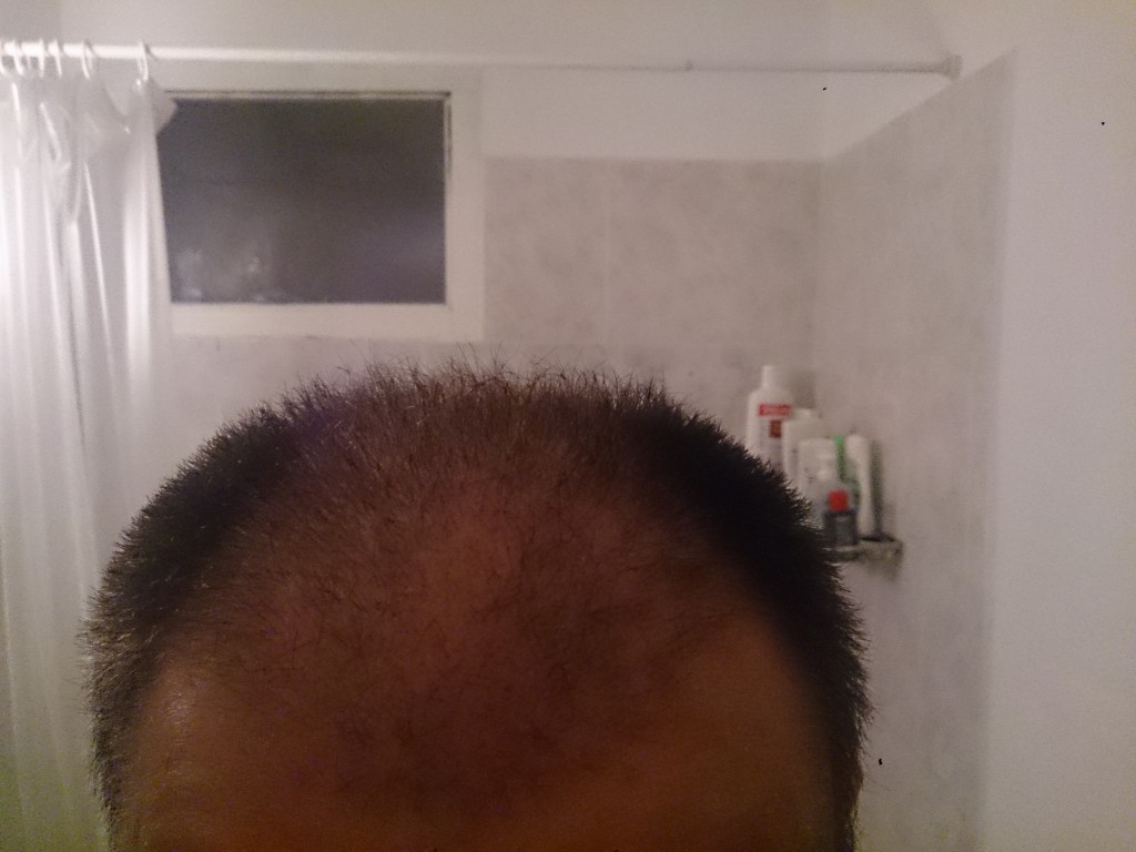 1 mes, 5 días, frente poca luz